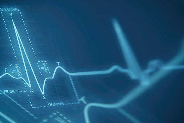 Electrocardiogram diagnostic test