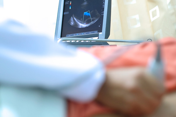 Echocardiography heart imaging